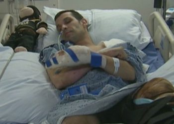 Boston Marathon bombing survivor Marc Fucarile rests in a hospital bed after the second bomb detonated in his path in 2013. (Marc Fucarile)
