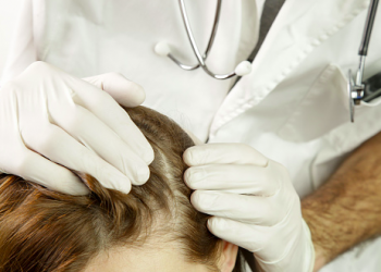 Best Hair Loss Treatments For Women