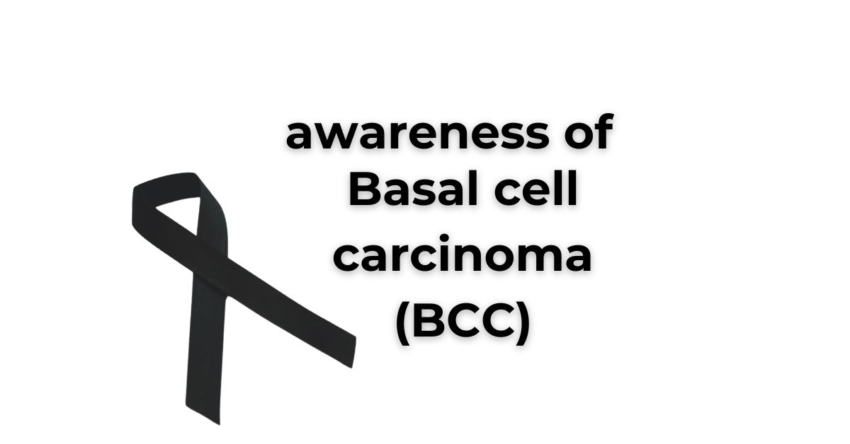 Basal cell carcinoma (BCC)
