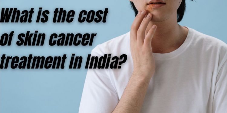 Skin Cancer Treatment Cost in India