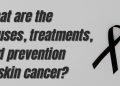 What are the causes, treatments, and prevention of skin cancer