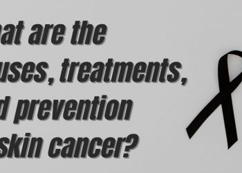 What are the causes, treatments, and prevention of skin cancer