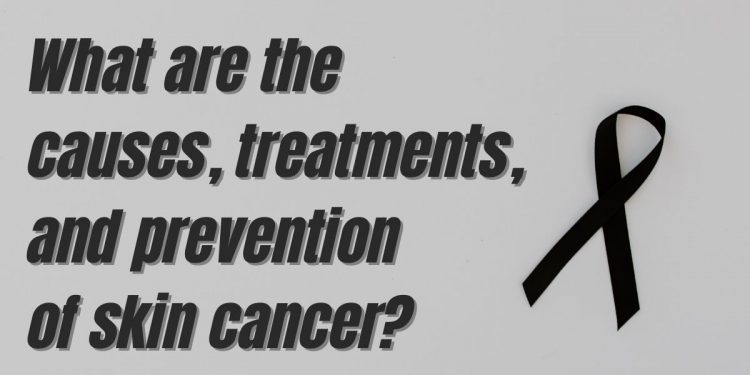 What are the causes, treatments, and prevention of skin cancer