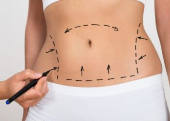 Best Fat Reduction Treatments to Sculpt Your Dream Body!