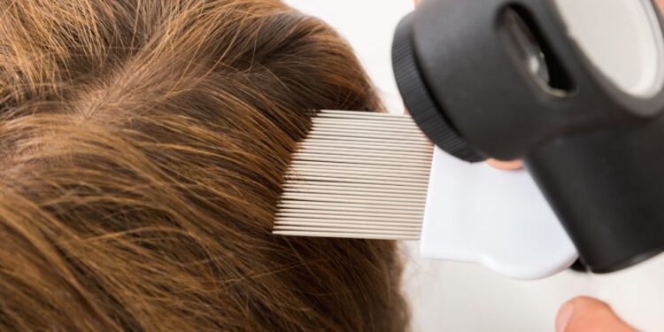 Proven Steps to Get Rid of Lice Fast at a Lice Salon