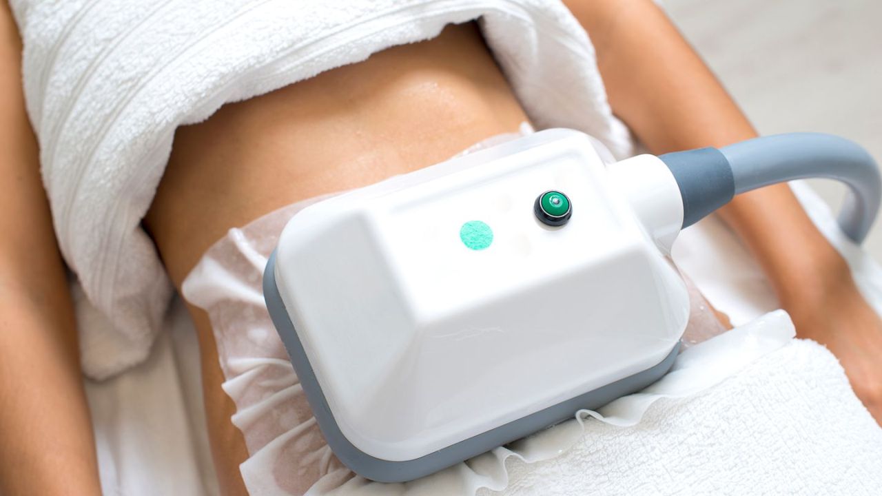 What is CoolSculpting