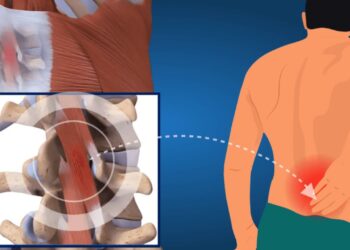 What Is Lower Back Pain and Why Does It Matter